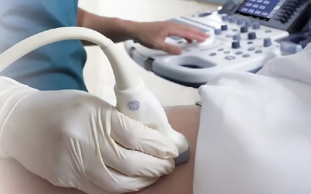 USG Doppler wątroby, USG Doppler układu wrotnego wątroby, USG przepływy wątrobowe