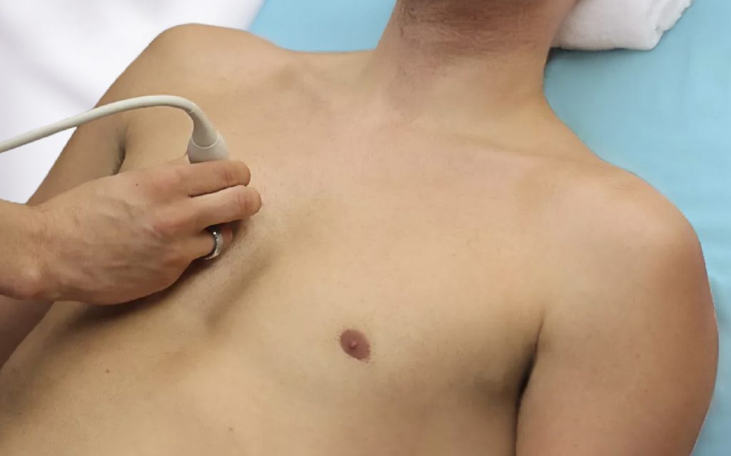 USG płuc Wrocław, USG płuc Wrocław prywatnie, USG płuc prywatnie, znanylekarz USG płuc